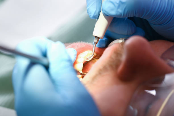 Best Emergency Dental Extractions in Stonewood, WV