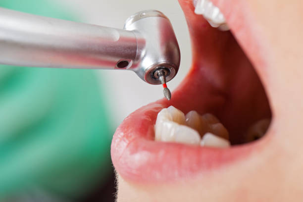 Best Orthodontic Emergency Dentist in Stonewood, WV